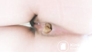 Stand poop - video 3