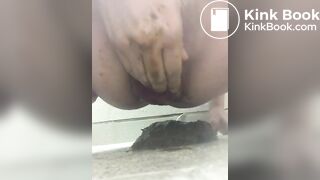prolapse and shit21