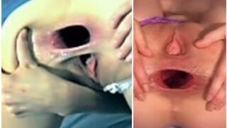 Hornydoll - Gaping Asshole - Fart - Shit - Prolapse (Compilation)