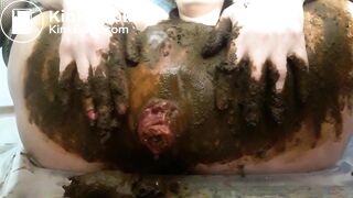 Scat anal prolapse video