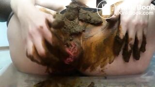 Scat anal prolapse video