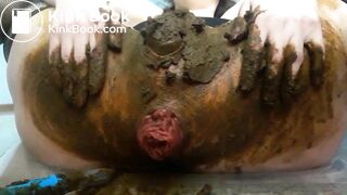Scat anal prolapse video