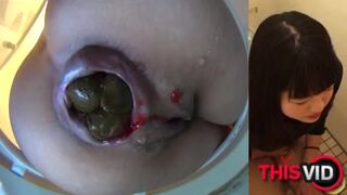 japanese scat 24 - video 2