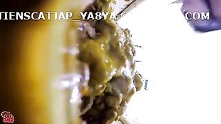 japanese diarrhea 15