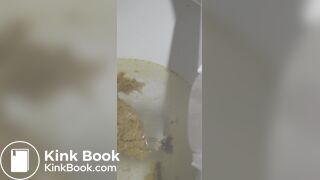 Korean girl diarrhea 2