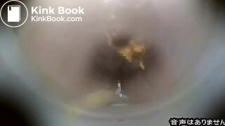 The camera in face 4