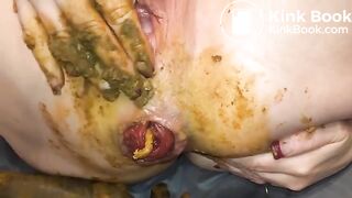 Shitty prolapse - video 4