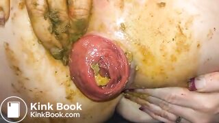 Shitty prolapse - video 4