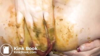 Shitty prolapse - video 4