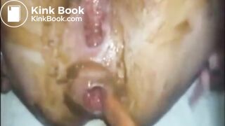 couple scat fuck anal a2p