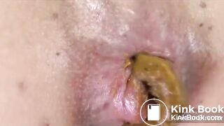 Anal clean