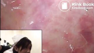 super crazy scat vid 1