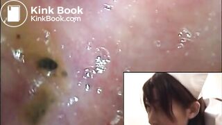 super crazy scat vid 1