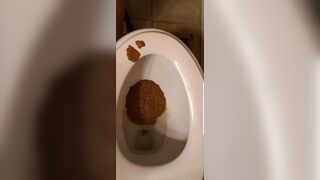 Diarrhea and dirty ass