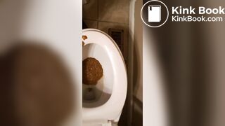 Diarrhea and dirty ass