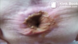 extremly close pooping footage - video 5