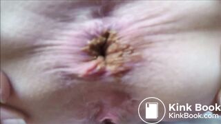extremly close pooping footage - video 5