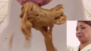 Unusual combination of hard and soft poop