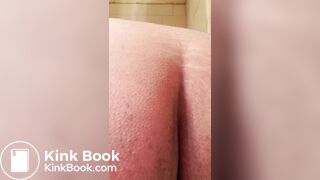 Diarrhea with ass wipe