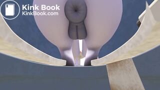 Flitter Quick Stop Sfm