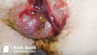 SHARTS & FARTS VOL.3