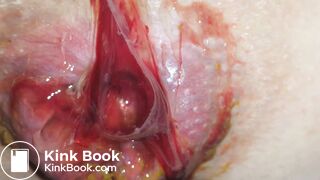 SHARTS & FARTS VOL.3