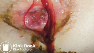 SHARTS & FARTS VOL.3