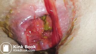 SHARTS & FARTS VOL.3