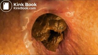 very close pooping footage. - video 6