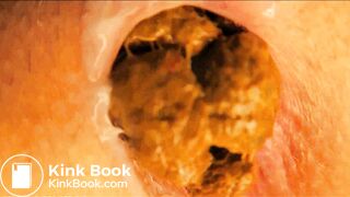 very close pooping footage. - video 6