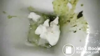 Green diarrhea