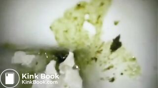 Green diarrhea