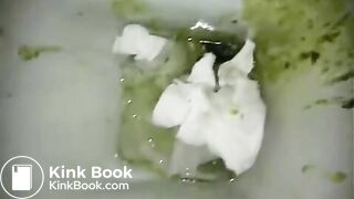 Green diarrhea
