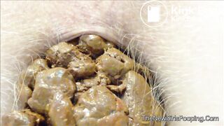 very close pooping footage. - video 7