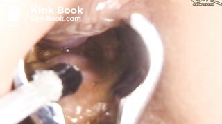 See inside butthole By Speculum