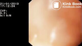 Look inside woman’s ass