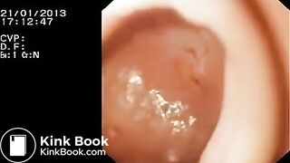 Look inside woman’s ass