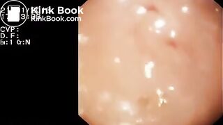 Look inside woman’s ass