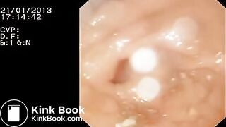 Look inside woman’s ass