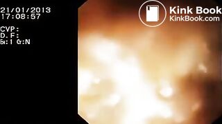 Look inside woman’s ass