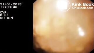 Look inside woman’s ass