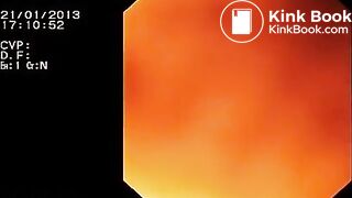 Look inside woman’s ass