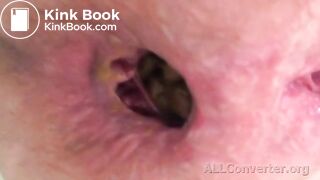 Close up pooping - video 4