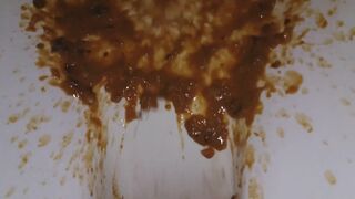 diarrhea - video 79