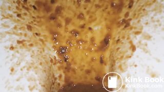 diarrhea - video 79