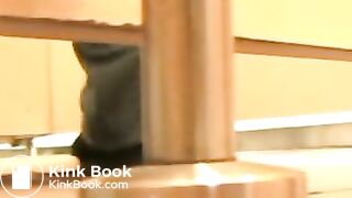 Japanese toilet prolapse