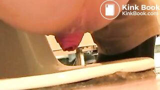 Japanese toilet prolapse