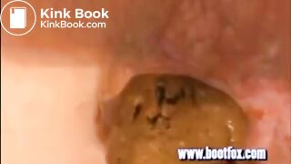 15 days without shitting