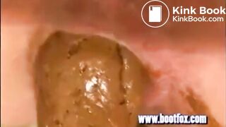 15 days without shitting