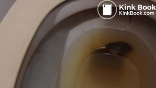 fc pee and shit smear